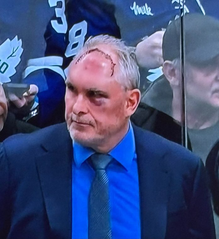 Las bromas de un entrenador de la NHL que mostró una impactante cicatriz en su cabeza: “El otro se ve mucho peor”