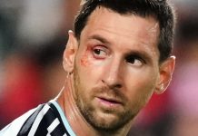 El corte en el ojo que sufrió Lionel Messi durante el duelo entre Argentina y Suiza del Mundial 2026
